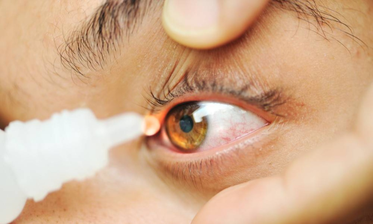 Вебинар для офтальмологов  «Синдром сухого глаза у разных категорий пациентов».