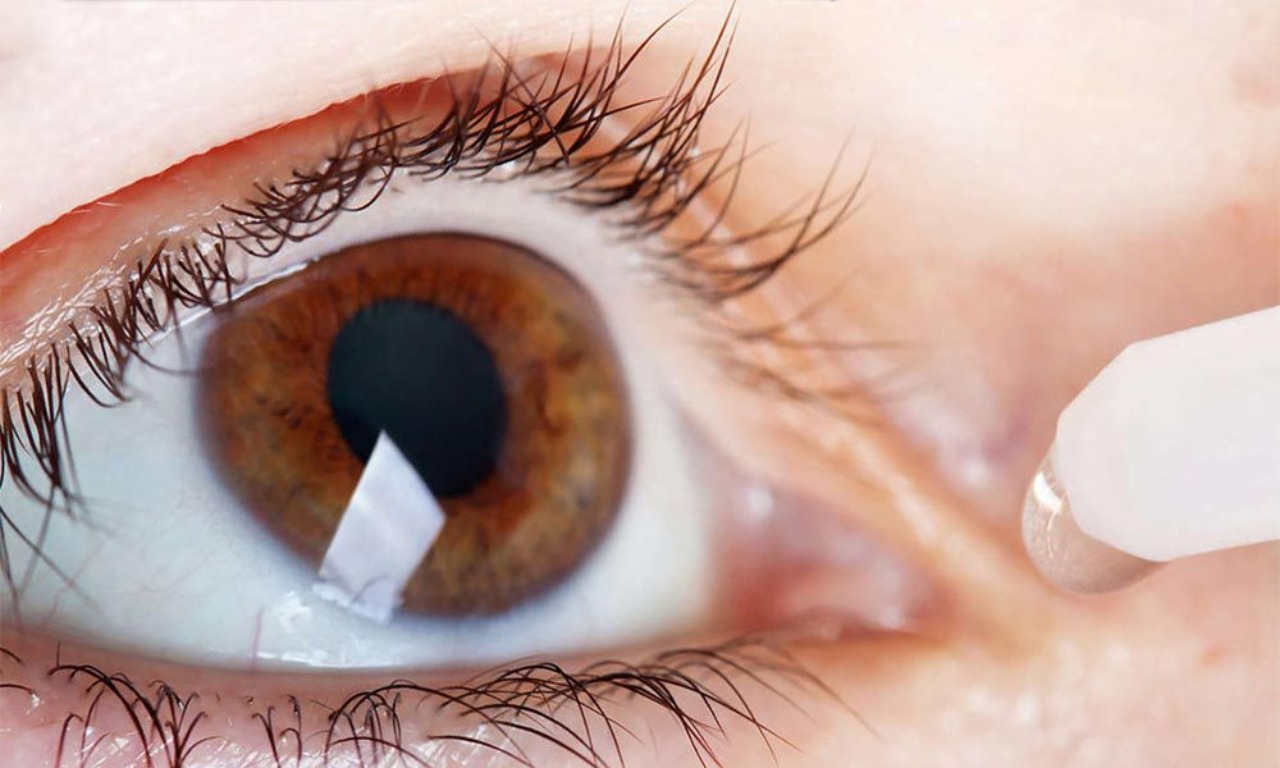 Вебинар для офтальмологов: «Синдром «сухого глаза» и лазерная рефракционная хирургия»