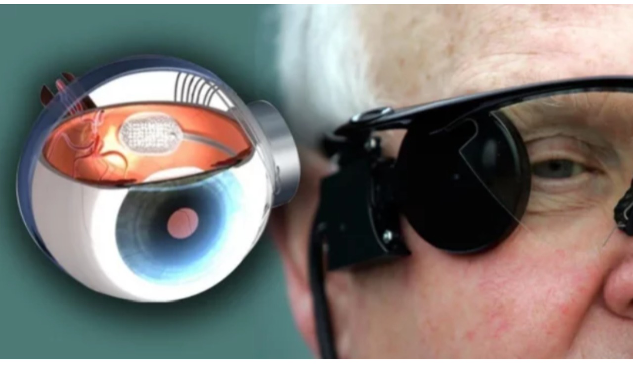 Шаман восстановил зрение слепому. Бионический глаз Argus II. Бионический глаз Argus. Искусственная сетчатка Argus II. Бионический протез Argus II.